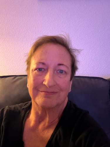 Reviewer showing their smooth, rejuvenated skin after using the Seranova Micro Infusion System.