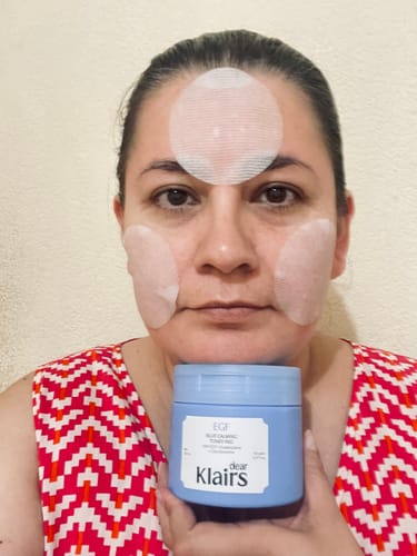 Customer's EGF Blue Calming Toner Pads applied to forehead and cheeks with the blue jar held in hand.