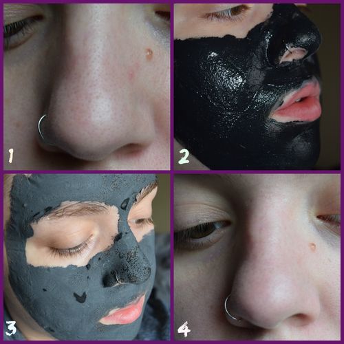 Customer photo review of Activated Charcoal Face Mask