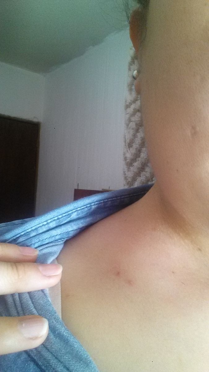 Customer photo review of Suero Corporal Humectante Mongongo con Pachuli