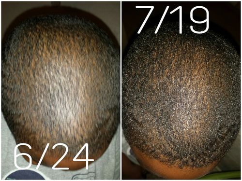 Customer photo review of Combo pack