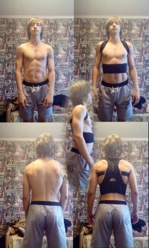 Customer photo review of Posture Therapy Back Brace