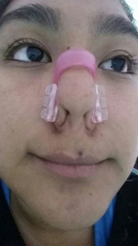 Customer photo review of Nose Shaper