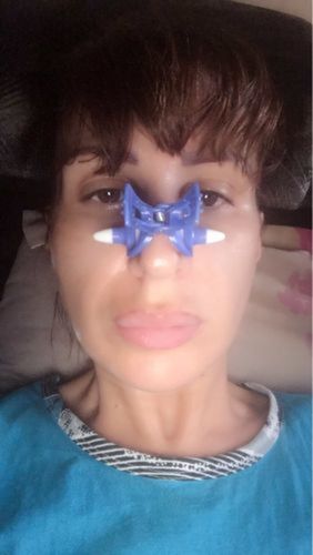 Customer photo review of Nose Shaper
