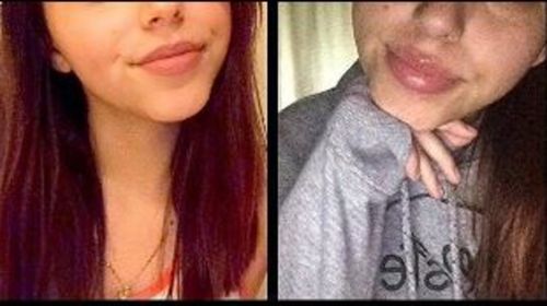 Customer photo review of Professional Lip Enhancing Pump