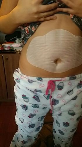 Customer photo review of Wonder Belly Slimming Patch - Offer