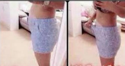 Customer photo review of Wonder Belly Slimming Patch