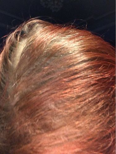 Customer photo review of Premium Hair Building Fibers