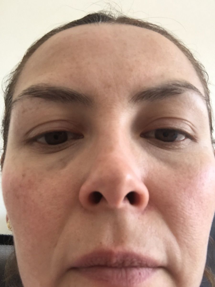 Customer photo review of Corrector VAINILLA