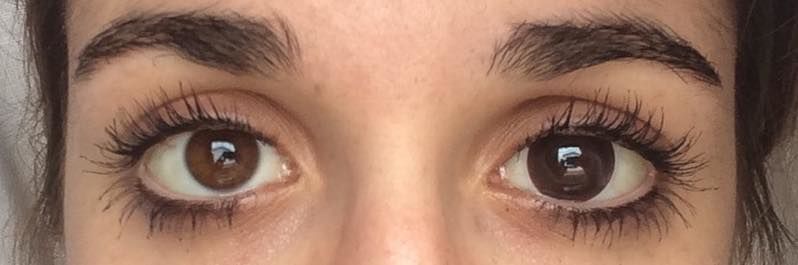 Customer photo review of Twilight Choco (prescription)
