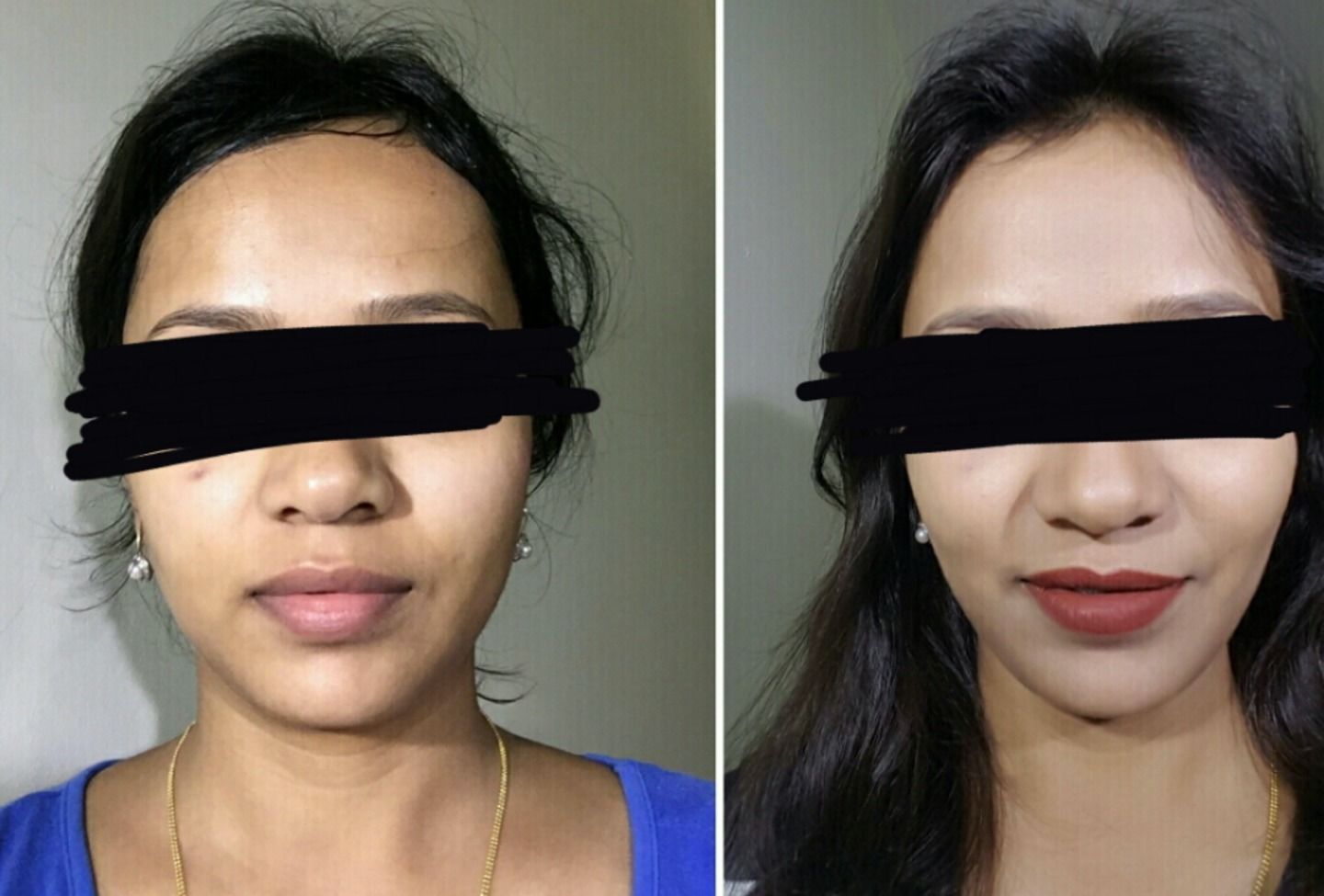 Customer photo review of 10X Cream - Facial Skin Whitening Cream