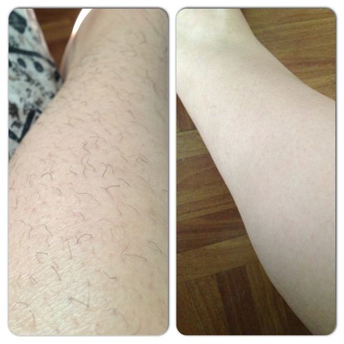 HAIR REMOVAL BUBBLE SPRAY