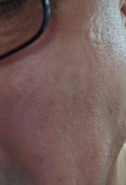 Customer photo review of Dr. wonder Wonder Patch
