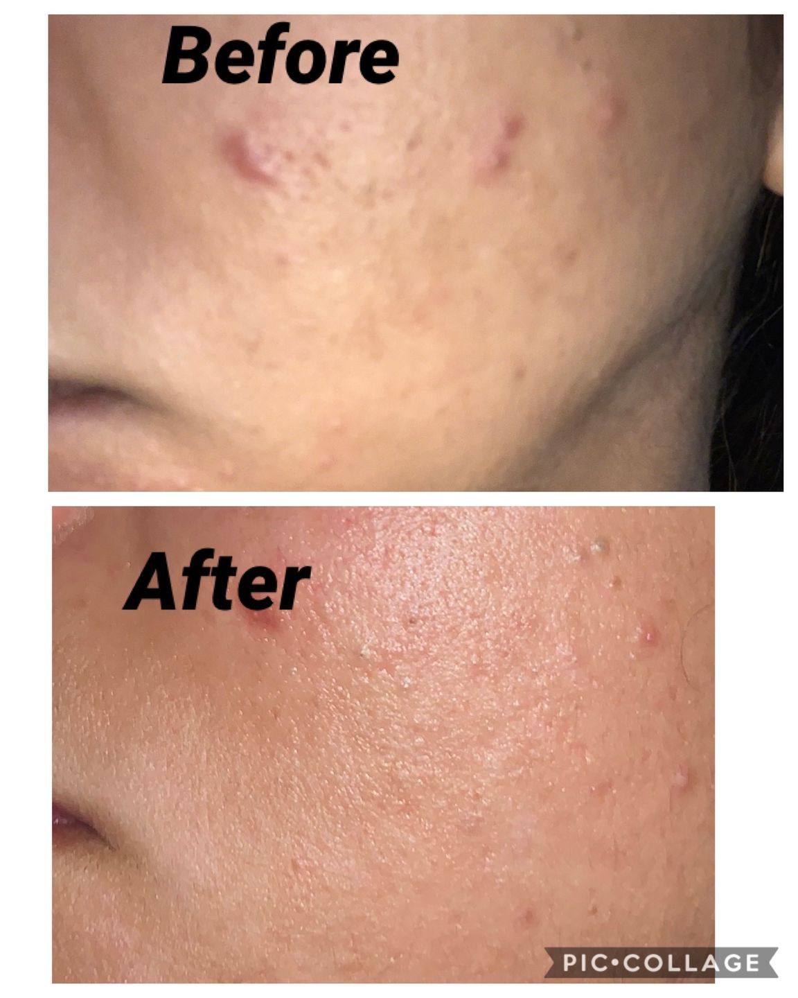 Customer photo review of 10X Cream - Facial Skin Whitening Cream