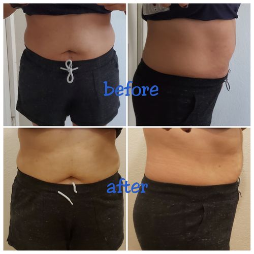 15 Uses Magnesium Wrap