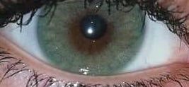 Customer photo review of Siesta Black Cloud Green
