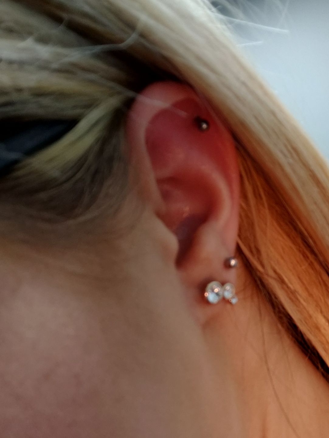 Customer photo review of NeilMed Sterile Saline Piercing Aftercare