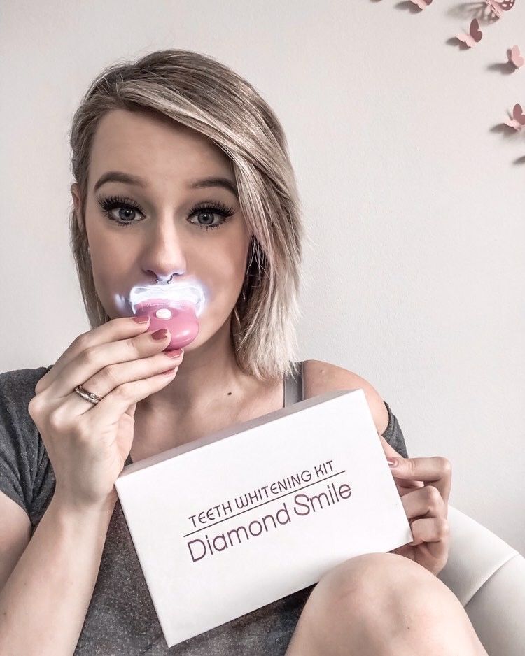 Customer photo review of Premium Zahnbleaching Set