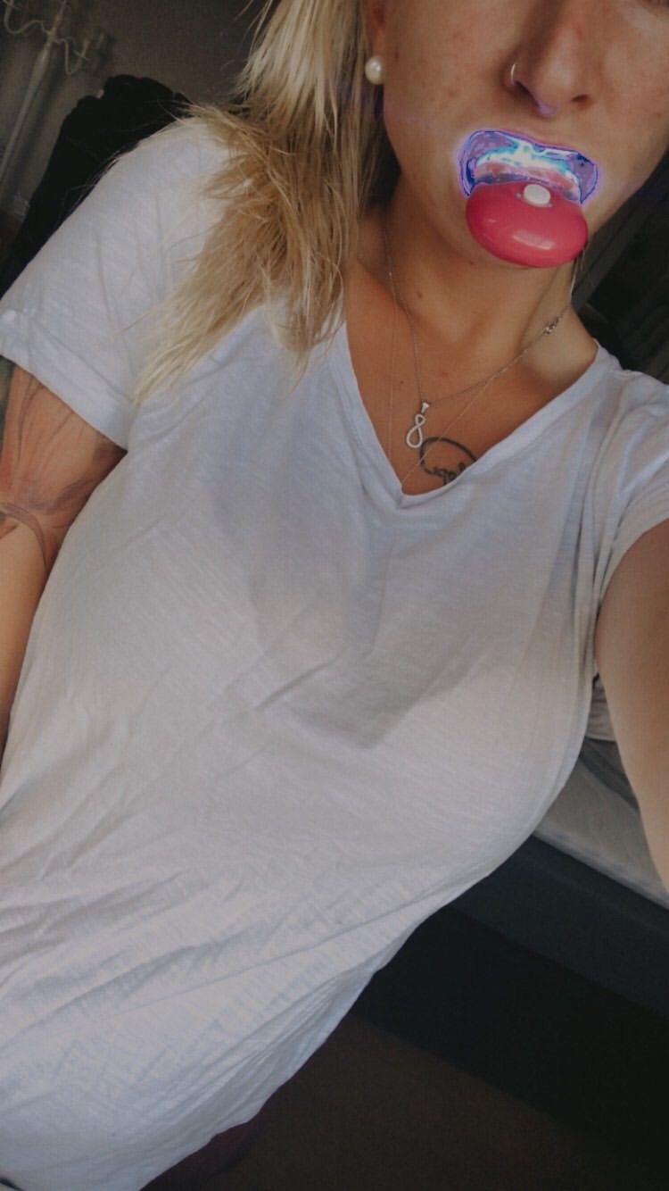Customer photo review of Premium Zahnbleaching Set