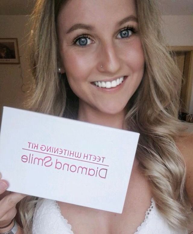 Customer photo review of Premium Zahnbleaching Set