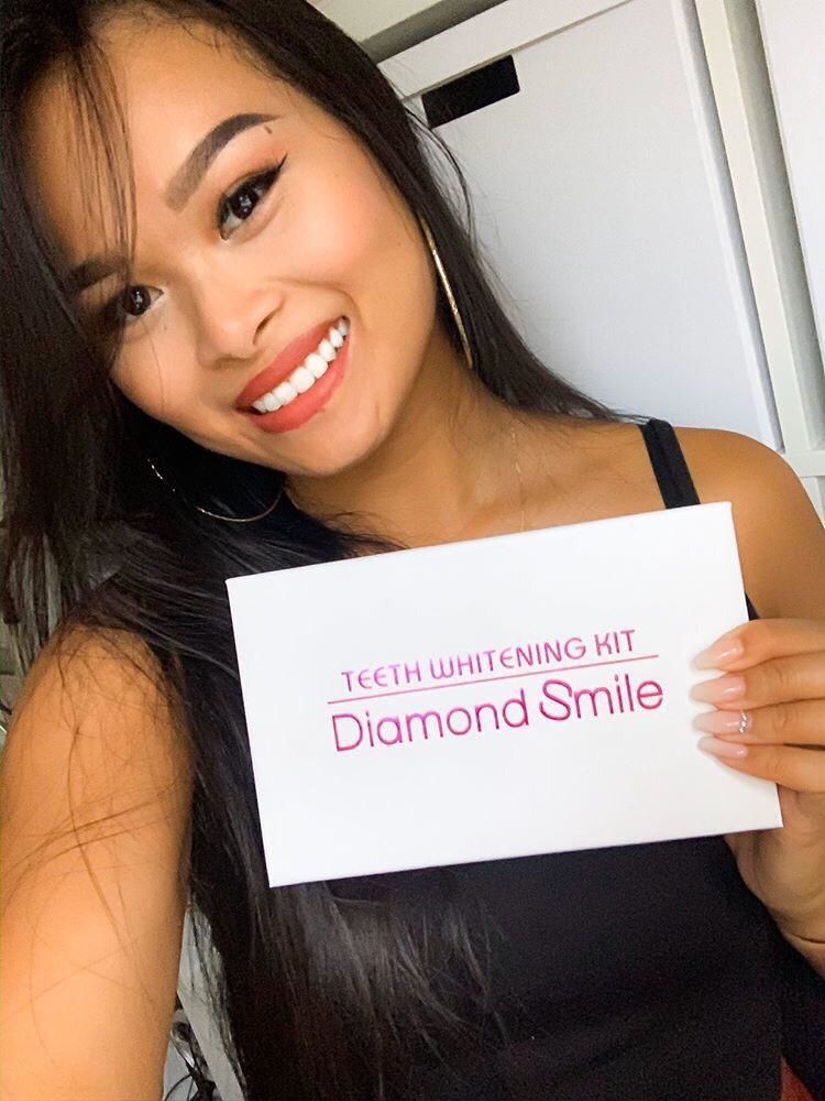 Customer photo review of Premium Zahnbleaching Set