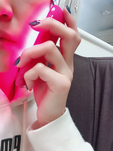 Customer photo review of YOUFE LED 紅光儀 (近紅外版) NR1