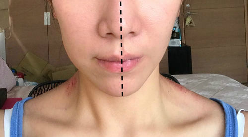 Customer photo review of YOUFE LED 紅光儀 (近紅外版) NR1