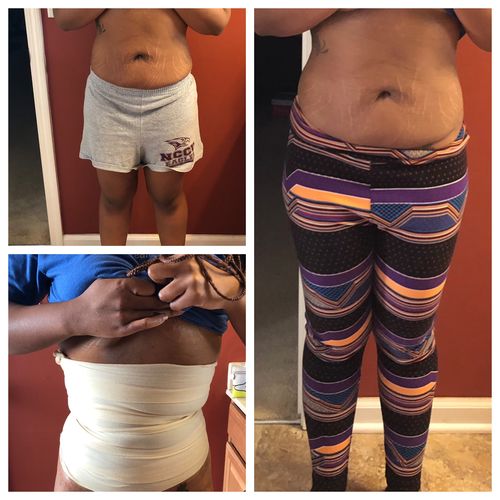 15 Uses Magnesium Wrap