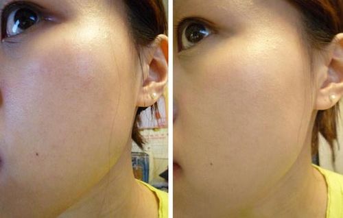 cosrx bha skin returning emulsion