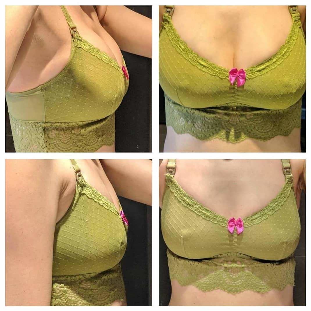 Customer photo review of Olivea Maternity and Nursing Bra