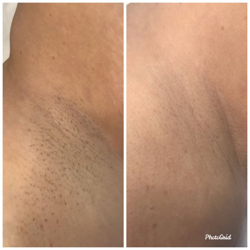 Customer photo review of Samplers | Use Code: " 1STSPLASH "