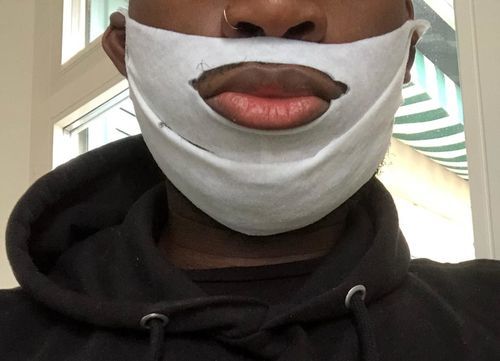 Customer photo review of DermaV™  |  Masque amincissant pour ovale du visage