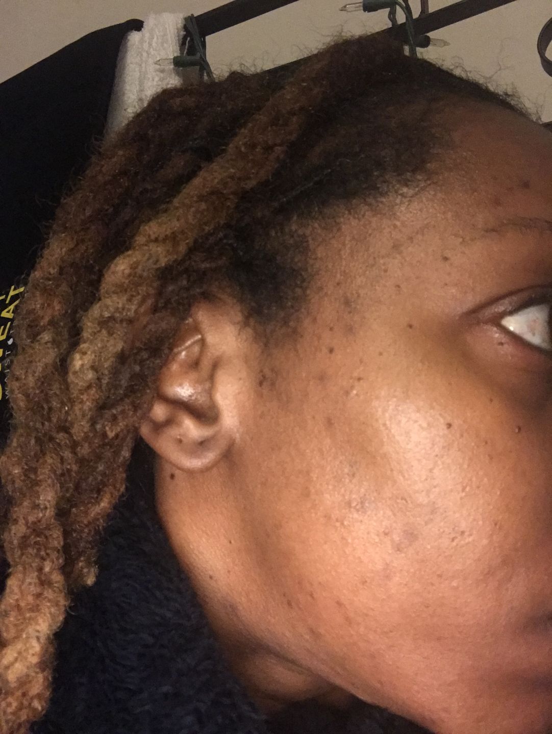 Customer photo review of Bolden Clear Skin Kit