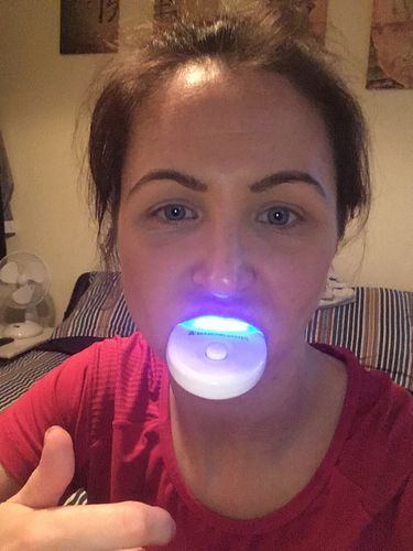 Customer photo review of Teeth Whitening Kit