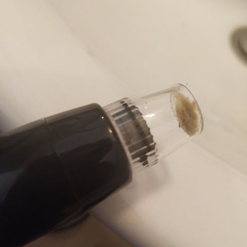 Customer photo review of Vacuum Blackhead Remover