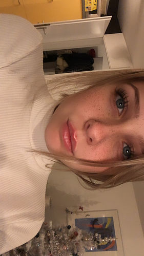 Customer photo review of LIP BOOSTING SYSTEM