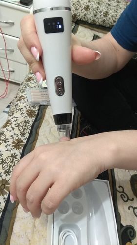 Customer photo review of Vacuum Blackhead Remover