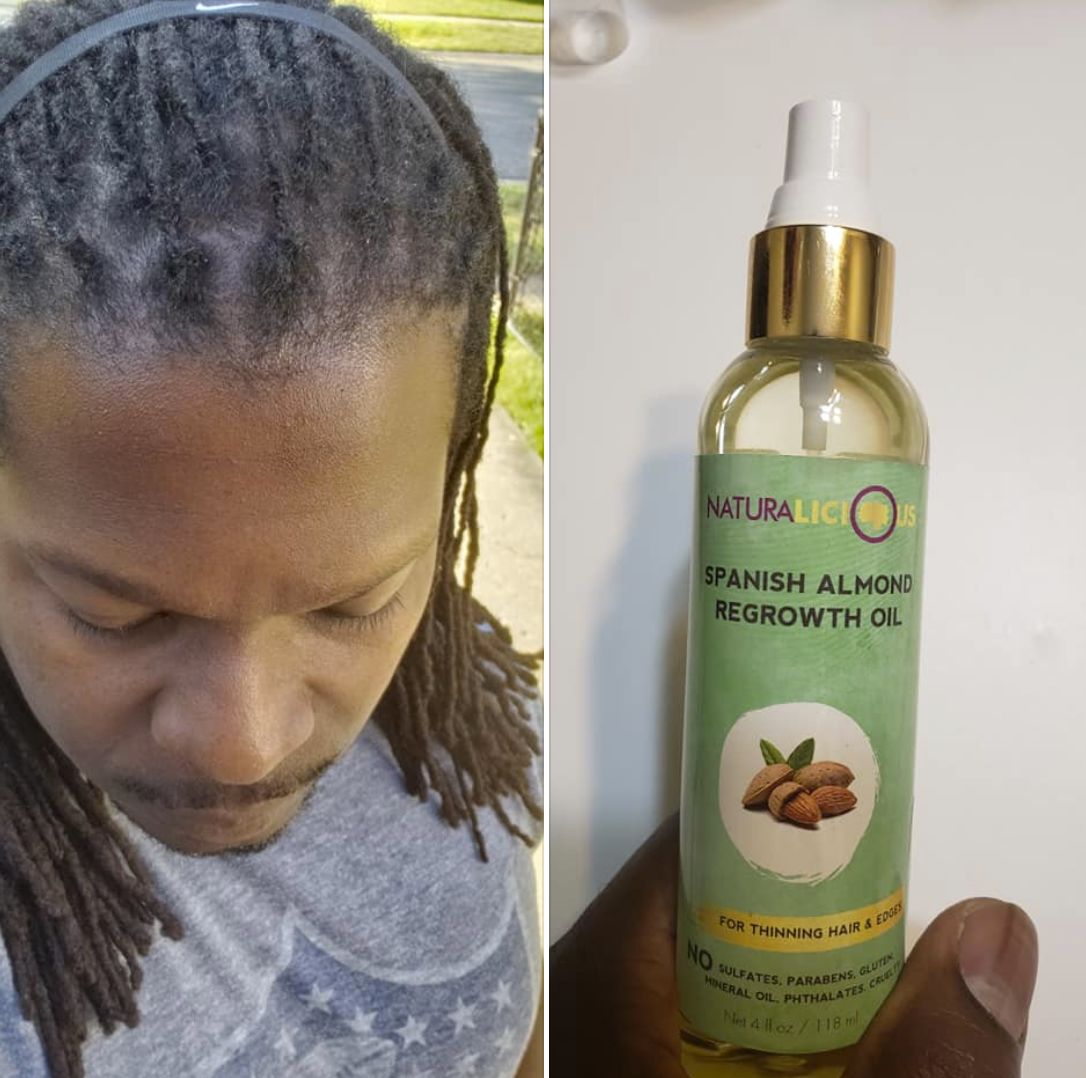 Customer photo review of Spanish Almond Regrowth Oil