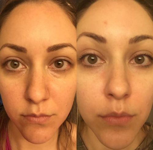 review eye cream sulwhasoo