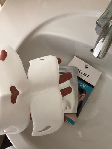 Customer photo review of DermaV™  | Masque amincissant pour ovale du visage