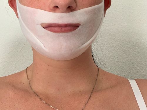 Customer photo review of DermaV™  | Masque amincissant pour ovale du visage