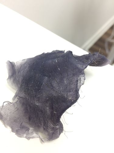 Customer photo review of Pro Series Hair Removal Wax