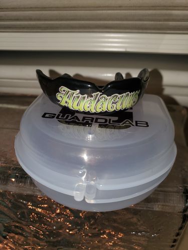 Customer photo review of APEX™ Customized