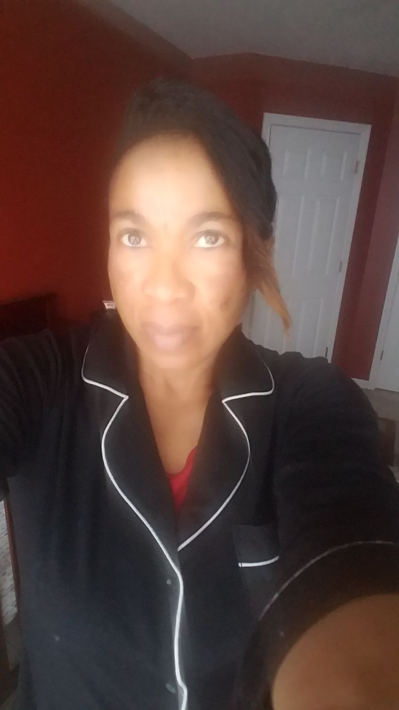 Customer photo review of Fair and White Exclusive Gel Cream 30ml / 1 fl oz