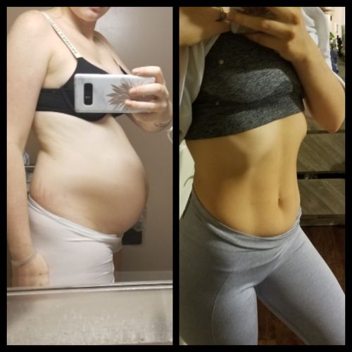 Customer photo review of (BOGO) AWAKEN: Skin Repair Intensive Healing Serum