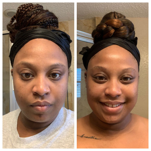 Customer photo review of Cleansing Kit