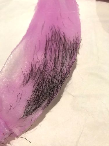 Customer photo review of Signature Series Hair Removal Wax