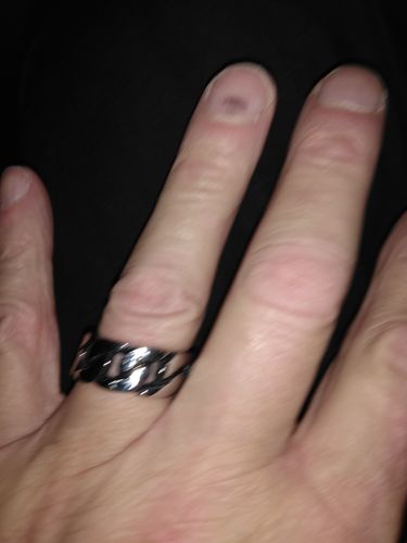Customer photo review of CHAIN RING