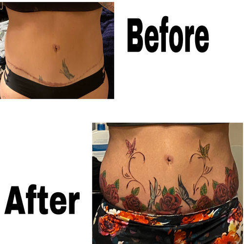 Customer photo review of Signature Tattoo Numbing Cream