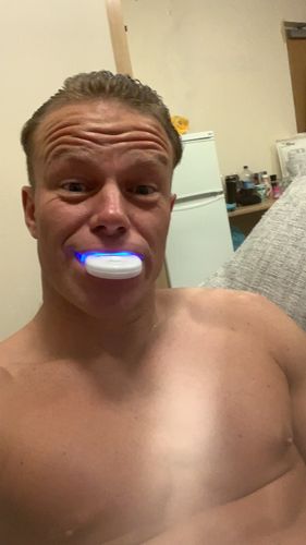 Customer photo review of Refill Kit